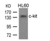 Western blot analysis of lysed extracts from HL60 cells using c-kit (Ab-936) .