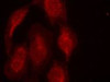 Immunofluorescence staining of methanol-fixed HeLa cells using CDK6 (Ab-13) .