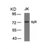 Western blot analysis of lysed extracts from JK cells using syk (Ab-323) .