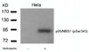 Western blot analysis of lysed extracts from HeLa cells untreated or treated with Hydroxyurea using p95/NBS1 (Phospho-Ser343) .