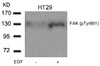 Western blot analysis of lysed extracts from HT29 cells untreated or treated with EGF using FAK (Phospho-Tyr861) .