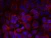 Immunofluorescence staining of methanol-fixed MCF cells using HER2 (Phospho-Tyr1221/Tyr1222) .