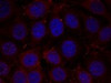 Immunofluorescence staining of methanol-fixed MCF cells using IGF-1R (Phospho-Tyr1165/Tyr1166) .