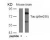 Western blot analysis of lysed extracts from mouse brain tissue using Tau (Phospho-Ser235) .