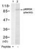 Western blot analysis of lysed extracts from HUVEC cells using p90RSK (Phospho-Ser352) .