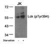Western blot analysis of lysed extracts from JK cells untreated or treated with starvation using Lck (Phospho-Tyr394) .