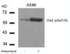 Western blot analysis of lysed extracts from A549 cells untreated or treated with Anisomycin using Chk2 (Phospho-Ser516) .