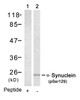 Western blot analysis of lysed extracts from mouse brain tissue using &#945;-Synuclein (Phospho-Ser129) .