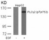 Western blot analysis of lysed extracts from HepG2 cells untreated or treated with EGF using PLC&#947;2 (Phospho-Tyr753) .