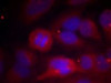 Immunofluorescence staining of methanol-fixed HeLa cells using Tyrosine Hydroxylase (Phospho-Ser40) .