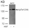 Western blot analysis of lysed extracts from A431 cells untreated or treated with HGF using Met (Phospho-Tyr1234) .