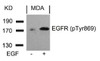 Western blot analysis of lysed extracts from MDA cells untreated or treated with EGF using EGFR (Phospho-Tyr869) .