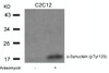 Western blot analysis of lysed extracts from C2C12 cells untreated or treated with Anisomycin using &#945;-Synuclein (Phospho-Tyr125) .