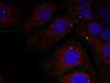 Immunofluorescence staining of methanol-fixed HeLa cells using &#945;-Synuclein (Phospho-Tyr125) .