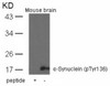 Western blot analysis of lysed extracts from mouse brain tissue using &#945;-Synuclein (Phospho-Tyr136) .