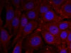 Immunofluorescence staining of methanol-fixed HeLa cells using &#945;-Synuclein (Phospho-Tyr136) .