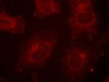 Immunofluorescence staining of methanol-fixed HeLa cells using Gab1 (Phospho-Tyr627) .