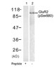 Western blot analysis of lysed extracts from mouse brain tissue using Glutamate receptor 2 (Precursor) (phospho-Ser880) .