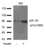 Western blot analysis of extract from 293 cells using IGF-1R (Phospho-Tyr1280) .