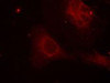 Immunofluorescence staining of methanol-fixed HeLa cells using Shc1 (Phospho-Tyr349) .