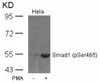 Western blot analysis of lysed extracts from HeLa cells untreated or treated with PMA using Smad1 (Phospho-Ser465) .
