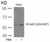 Western blot analysis of lysed extracts from HeLa cells untreated or treated with PMA using Smad2 (Phospho-Ser467) .