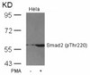Western blot analysis of lysed extracts from HeLa cells untreated or treated with PMA using Smad2 (Phospho-Thr220) .