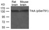 Western blot analysis of lysed extracts from Rat and Mouse brain tissue using TrkA (Phospho-Ser791) .