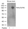 Western blot analysis of lysed extracts from mouse brain tissue using TrkB (Phospho-Tyr705) .