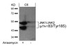 Western blot analysis of lysed extracts from C6 cells untreated or treated with anisomycin using JNK1/JNK2 (phospho-Thr183/Tyr185) .