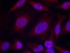 Immunofluorescence staining of methanol-fixed HeLa cells using JNK1/JNK2 (phospho-Thr183/Tyr185) .