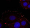 Immunofluorescence staining of methanol-fixed HeLa cells using FAK (phospho-Tyr576/Tyr577) .