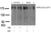 Western blot analysis of lysed extracts from PMA-treated HUVEC cells or EGF-treated MDA cells using EGFR (phospho-Tyr1197) goat polyclonal Antibody.