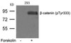 Western blot analysis of lysed extracts from 293 cells untreated or treated with FSK using &#946;-catenin (phospho-Tyr333) .