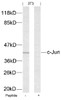 Western blot analysis of lysed extracts from 3T3 cells using c-Jun (Ab-63) .