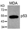 Western blot analysis of lysed extracts from MDA cells using p53 (Ab-6) .