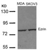 Western blot analysis of lysed extracts from MDA and SKOV3 cells using Ezrin (Ab-353) .