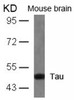 Western blot analysis of lysed extracts from mouse brain tissue using Tau (Ab-404) .