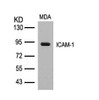 Western blot analysis of lysed extracts from MDA cells using ICAM-1 (Ab-512) .