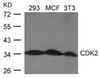 Western blot analysis of lysed extracts from A2780 cells using CDK2 (Ab-160) .