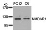 Western blot analysis of lysed extracts from PC12 and C6 cells using NMDAR1 (Ab-896) .