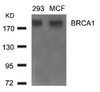 Western blot analysis of lysed extracts from 293 and MCF cells using BRCA1 (Ab-1524) .