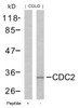Western blot analysis of lysed extracts from COLO cells using CDC2 (Ab-161) .