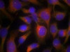 Immunofluorescence staining of methanol-fixed HeLa cells using Myosin Light Chain 2 (Ab-18) .