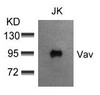 Western blot analysis of lysed extracts from JK cells using Vav (Ab-174) .