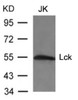 Western blot analysis of lysed extracts from JK cells using Lck (Ab-394) .