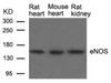 Western blot analysis of lysed extracts from Rat heart, Mouse heart and Rat kidney tissue using eNOS (Ab-1177) .