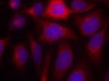 Immunofluorescence staining of methanol-fixed HeLa cells using eNOS (Ab-1177) .