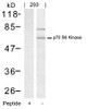 Western blot analysis of lysed extracts from 293 cells using p70 S6 Kinase (Ab-389) .