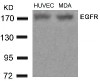 Western blot analysis of lysed extracts from HUVEC and MDA cells using EGFR (Ab-678) .